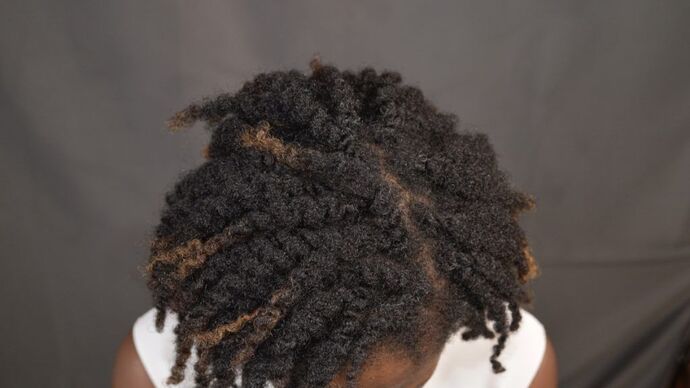 FUT Female: Case 2 - After