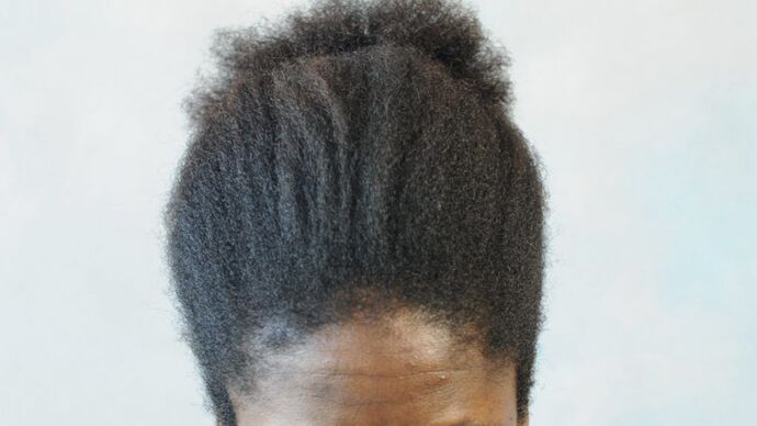 FUT Female: Case 2 - Before