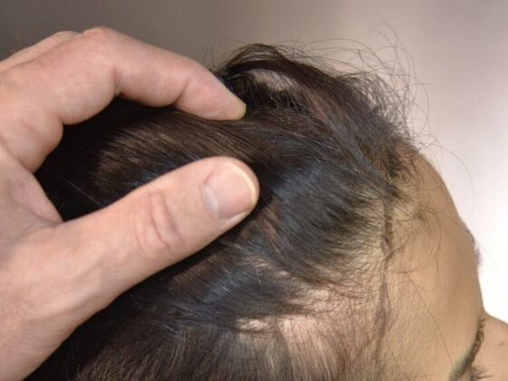 FUT Female Case 3 - Before