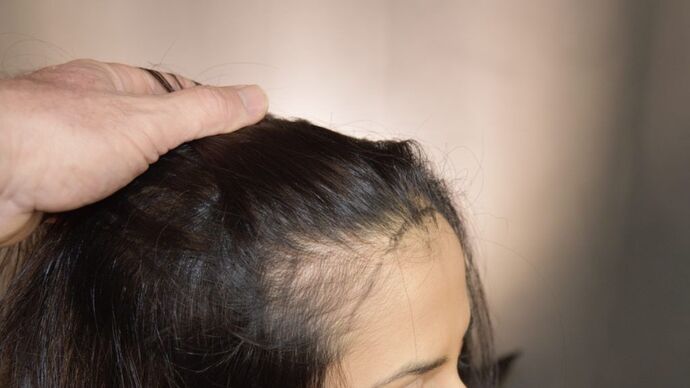 FUT Female: Case 3 - Before