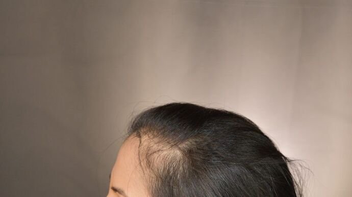 FUT Female: Case 3 - Before