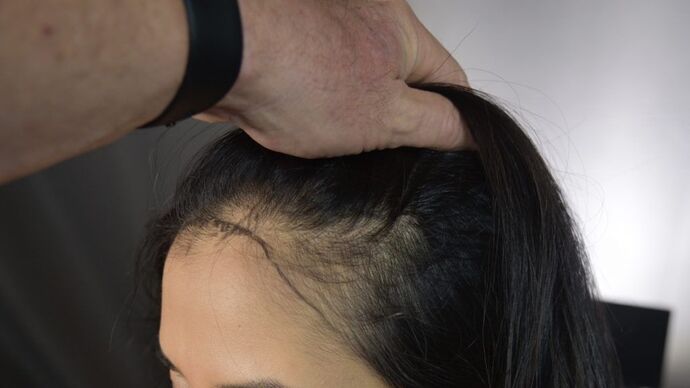 FUT Female: Case 3 - Before