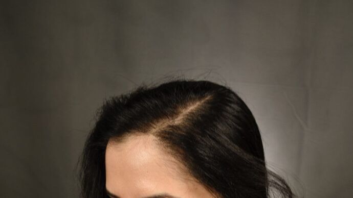 FUT Female: Case 3 - After