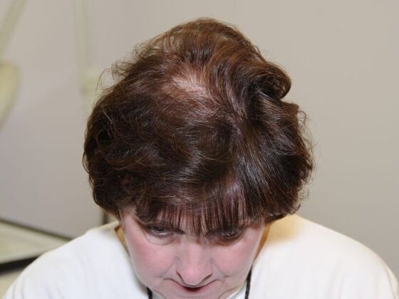 FUT Female: Case 5 - After