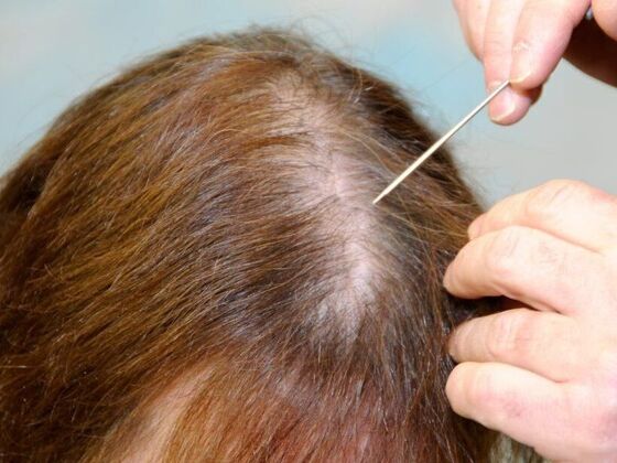 FUT Female: Case 5 - Before