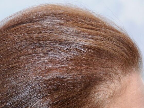 FUT Female Case 6 - After