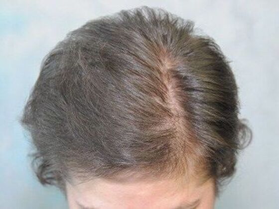 FUT Female: Case 7 - After