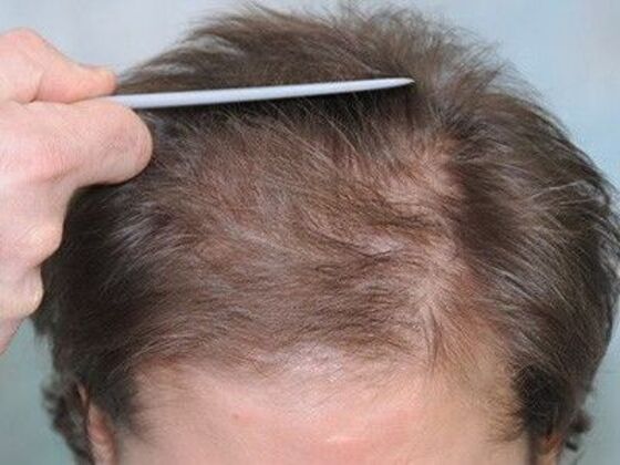 FUT Female: Case 7 - Before