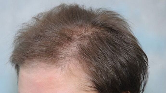 FUT Female: Case 7 - Before