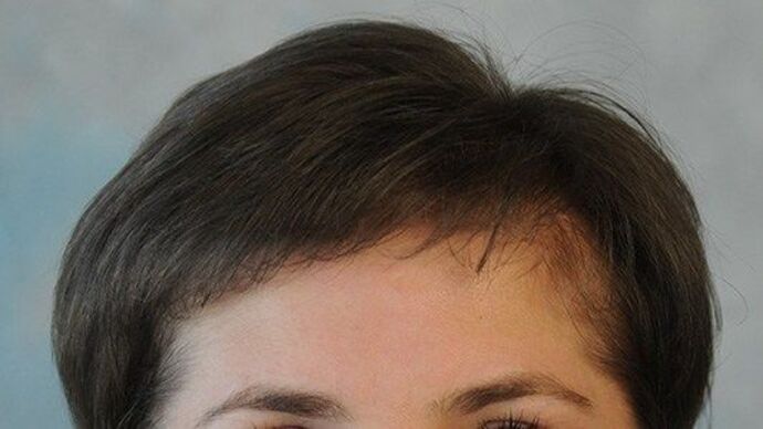 FUT Female: Case 7 - After