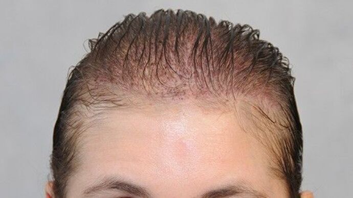 FUT Female: Case 7 - Before