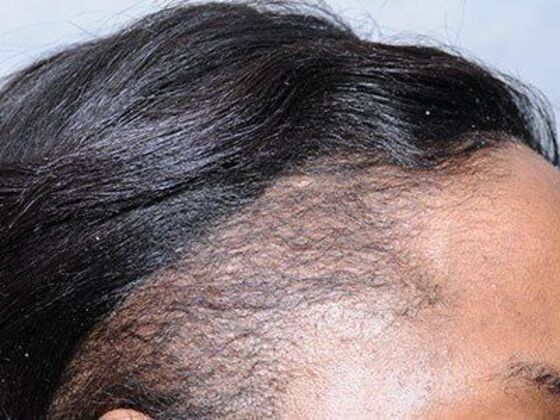 FUT Female: Case 8 - After