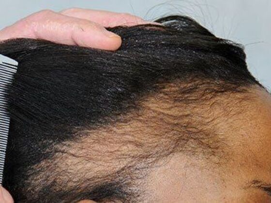 FUT Female: Case 8 - Before