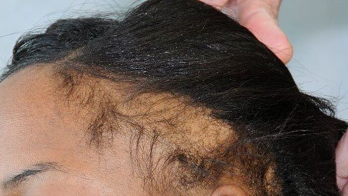 FUT Female: Case 8 - Before