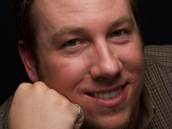 Smile Makeover: Xavier - After