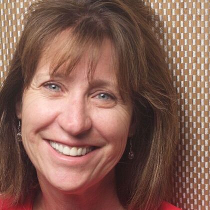 Smile Makeover Sue - Before