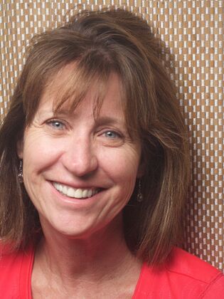 Full Mouth Rehabilitation  Sue - Before