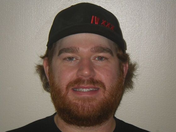 Invisalign: Case 13 - After