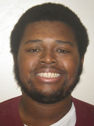 Invisalign: Case 14 - Before