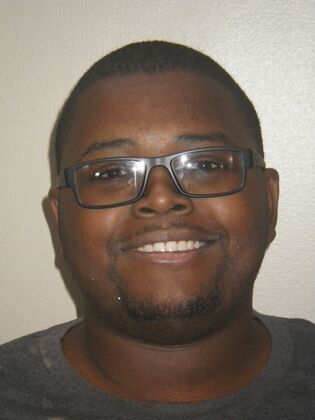 Invisalign: Case 14 - After