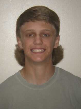Orthodontic treatment in Phases: Case 8 - After
