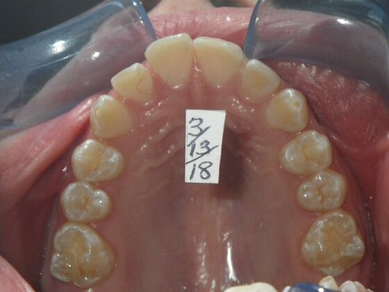 Orthodontics: Case 35 - Before