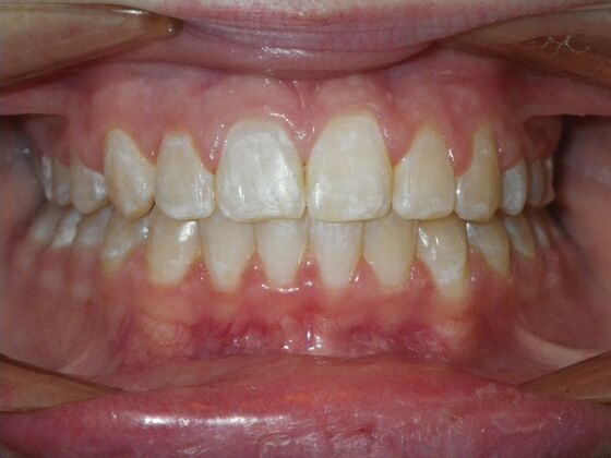 Orthodontics: Case 35 - After