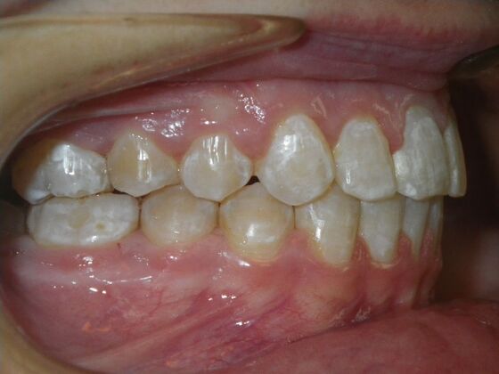 Orthodontics: Case 35 - After