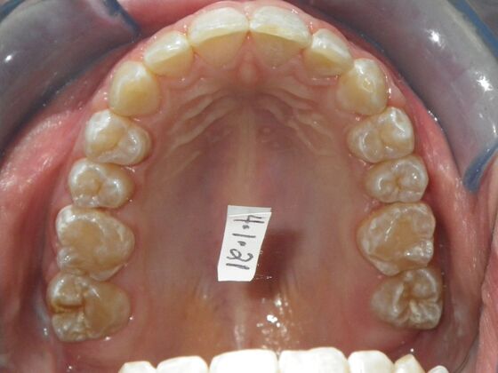 Orthodontics: Case 35 - After