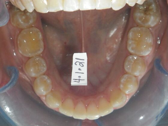 Orthodontics: Case 35 - After