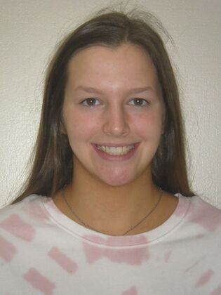 Orthodontics Case 35 - After