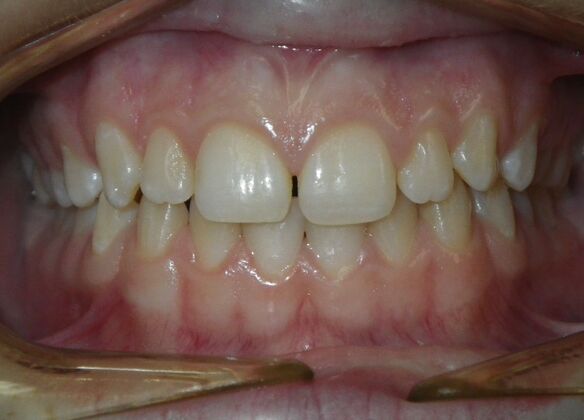 Orthodontics: Case 36 - Before