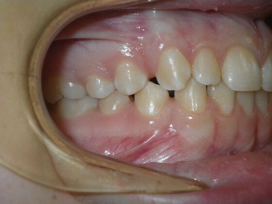 Orthodontics: Case 36 - Before