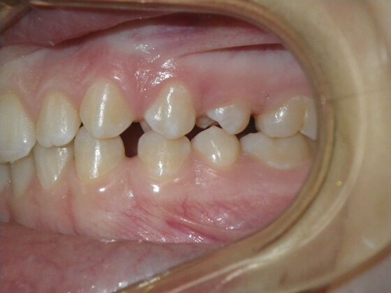 Orthodontics: Case 36 - Before