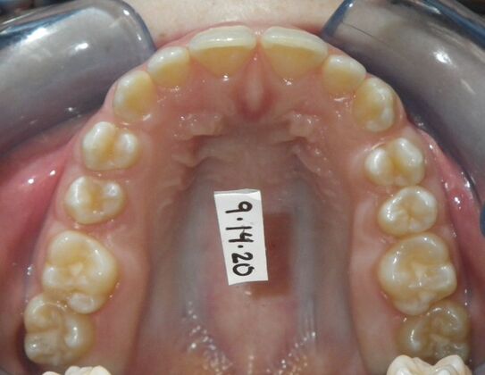 Orthodontics: Case 36 - Before