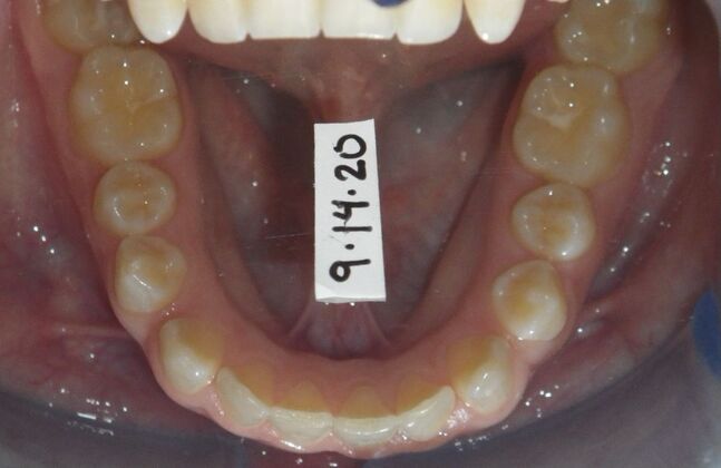 Orthodontics: Case 36 - Before