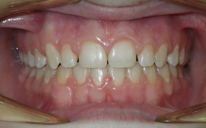 Orthodontics: Case 36 - After