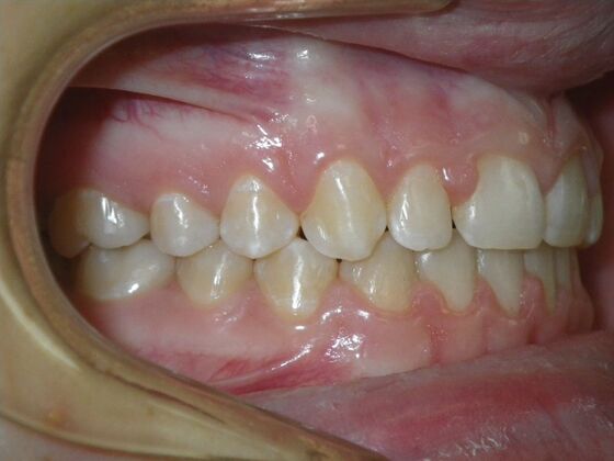 Orthodontics: Case 36 - After