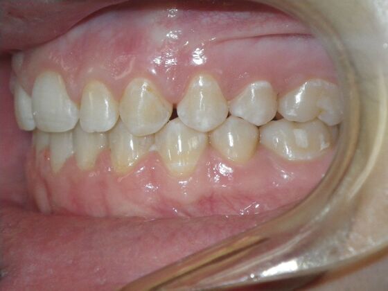 Orthodontics: Case 36 - After