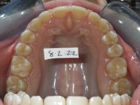 Orthodontics: Case 36 - After
