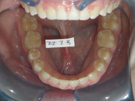 Orthodontics: Case 36 - After
