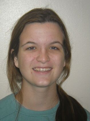 Orthodontics: Case 36 - After
