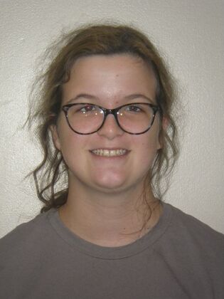 Orthodontics: Case 36 - Before