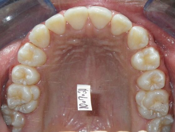 Orthodontics: Case 37 - After