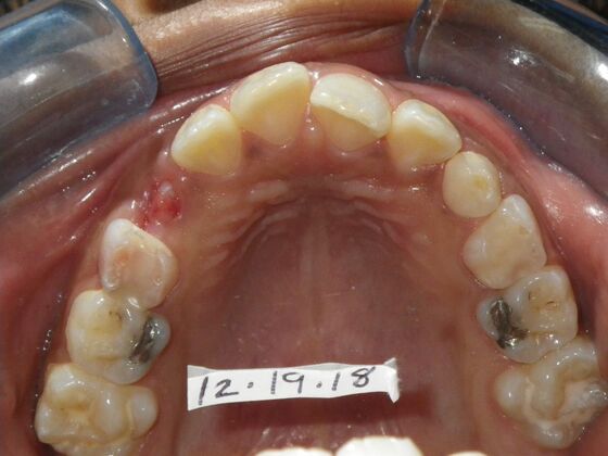 Orthodontics: Case 37 - Before