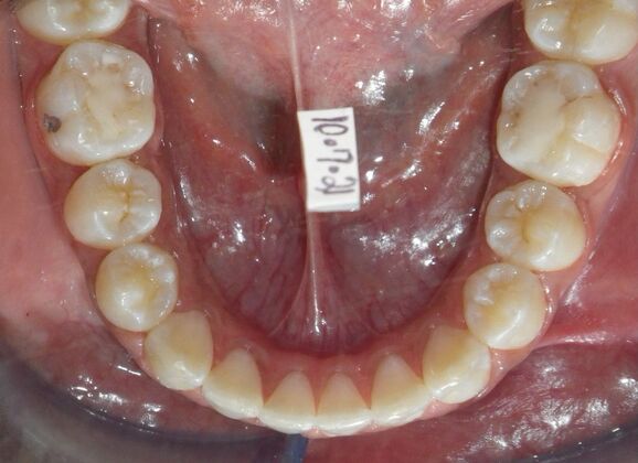 Orthodontics: Case 37 - After