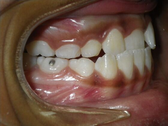 Orthodontics: Case 37 - Before
