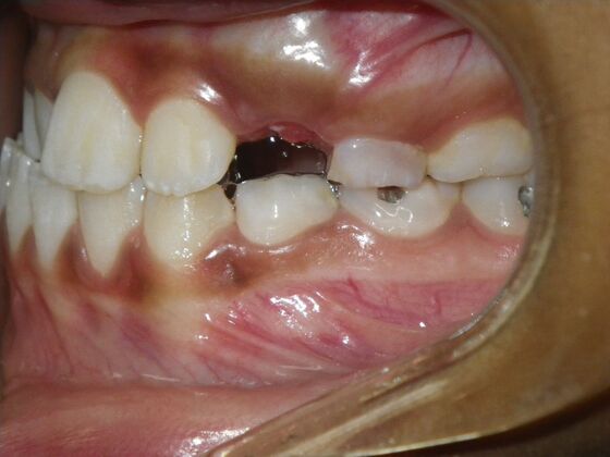Orthodontics: Case 37 - Before