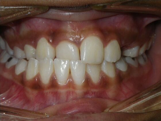 Orthodontics: Case 37 - After