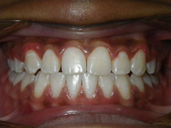 Orthodontics: Case 37 - Before